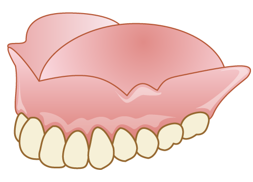 総入れ歯（全部床義歯）