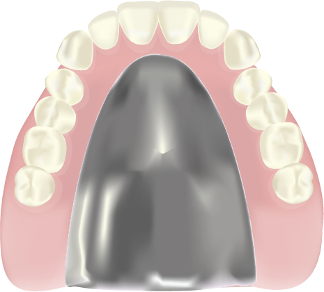 金属床義歯（チタン床）